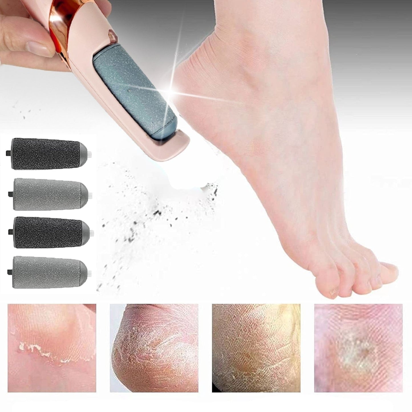 Soft Feet - Cracked Foot Callus Remover