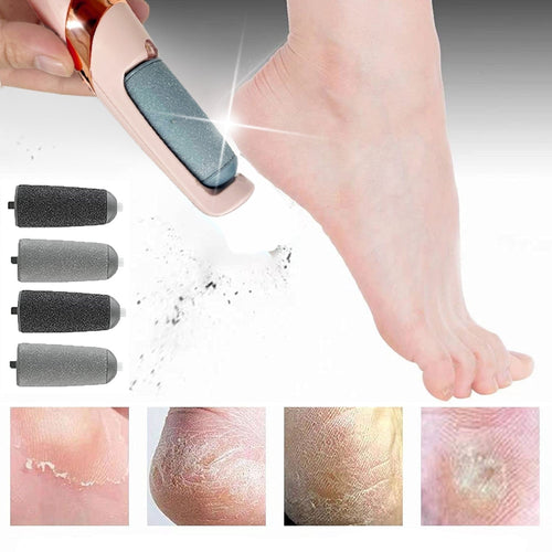 Soft Feet - Cracked Foot Callus Remover